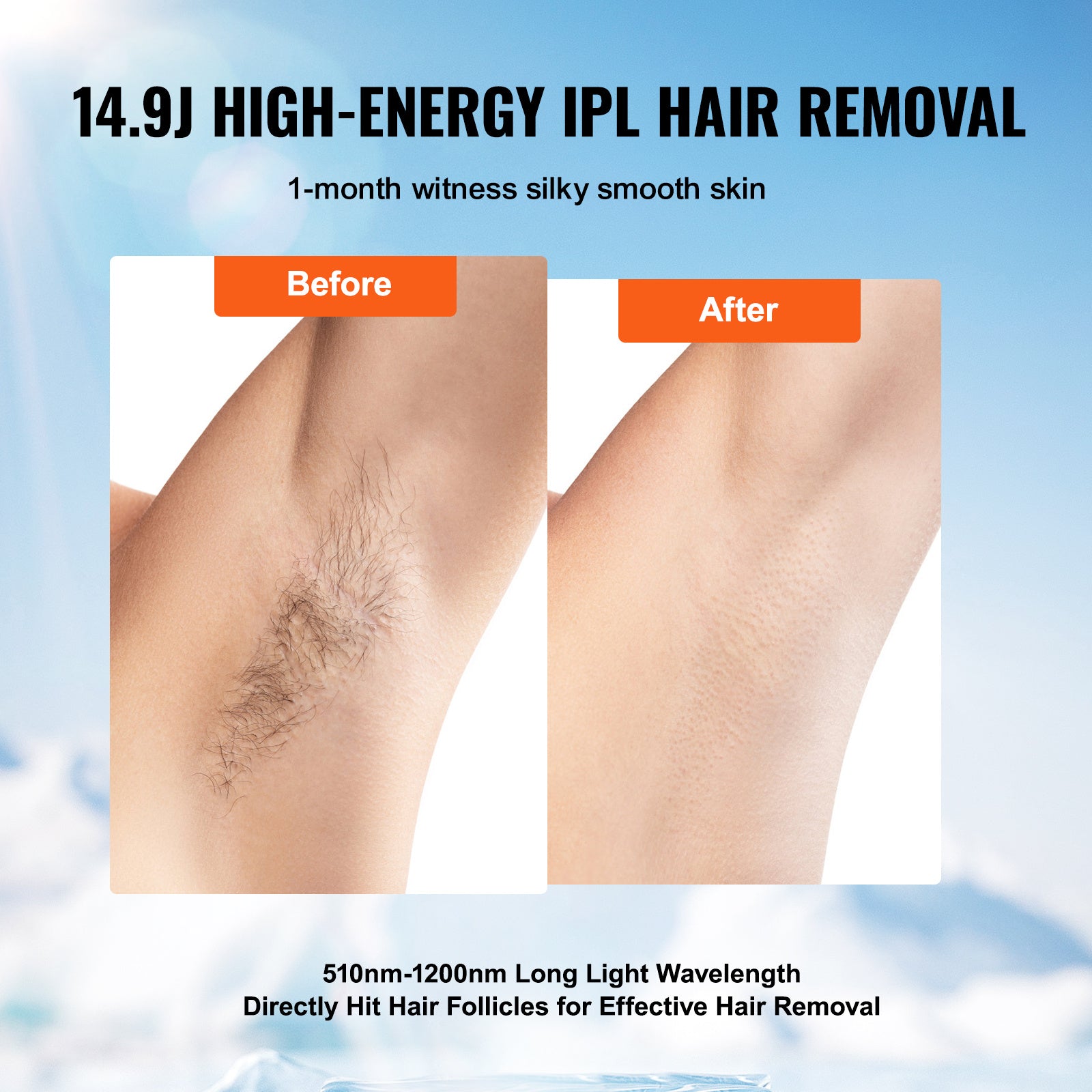 VEVOR IPL Hair Removal — Permanent At-Home Hair Removal Device (Auto & Manual, 5 Levels)